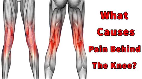 back of leg pain above knee